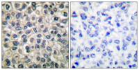 Catenin-γ Polyclonal Antibody