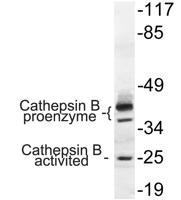 Cathepsin B Polyclonal Antibody