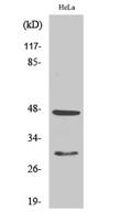 Cathepsin D Polyclonal Antibody