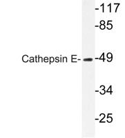 Cathepsin E Polyclonal Antibody