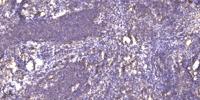 RNF130 Polyclonal Antibody