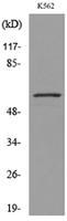 Glut5 Polyclonal Antibody