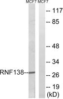 RNF138 Polyclonal Antibody