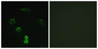 Glycerate Kinase Polyclonal Antibody