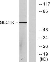 Glycerate Kinase Polyclonal Antibody