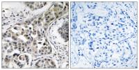 RN-tre Polyclonal Antibody