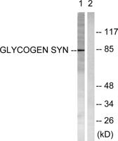 Glycogen Synthase 1 Polyclonal Antibody