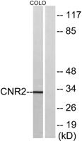 CB2 Polyclonal Antibody