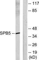 Maspin Polyclonal Antibody