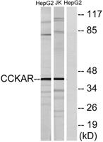 CCK-AR Polyclonal Antibody