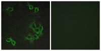 CCRL1 Polyclonal Antibody