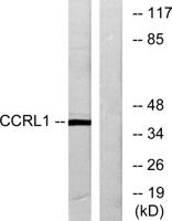 CCRL1 Polyclonal Antibody