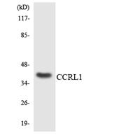 CCRL1 Polyclonal Antibody