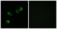 CCRL1 Polyclonal Antibody