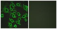CCRL2 Polyclonal Antibody