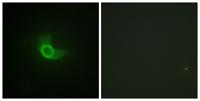 CD130 Polyclonal Antibody