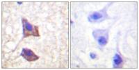 CD130 Polyclonal Antibody