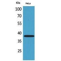 CD158b2/j Polyclonal Antibody