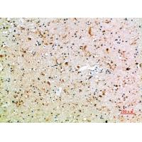 CD16 Polyclonal Antibody