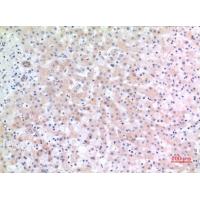 CD166 Polyclonal Antibody