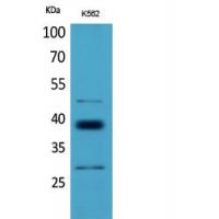 CD1D Polyclonal Antibody