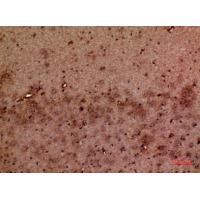 GMF-β Polyclonal Antibody