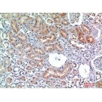 CD26 Polyclonal Antibody
