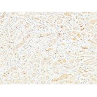 CD26 Polyclonal Antibody