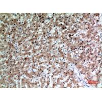 CD66e Polyclonal Antibody