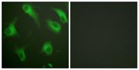 CD88 Polyclonal Antibody