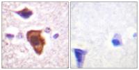 CD88 Polyclonal Antibody