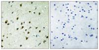Mad 4 Polyclonal Antibody