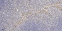 Macroglobulin α-2 Polyclonal Antibody