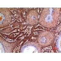 Macroglobulin α-2 Polyclonal Antibody