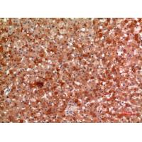 Macroglobulin α-2 Polyclonal Antibody