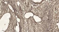 Rock-2 Polyclonal Antibody