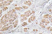 GnRH I Polyclonal Antibody