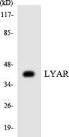 LYAR Polyclonal Antibody