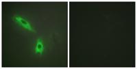 LT-β Polyclonal Antibody