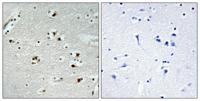 Cdc20 Polyclonal Antibody