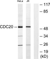 Cdc20 Polyclonal Antibody