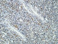 Cdc25B Polyclonal Antibody