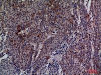 Cdc34 Polyclonal Antibody