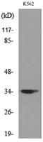 Cdc34 Polyclonal Antibody