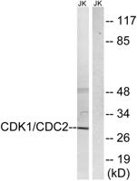 Cdk1/2/3 Polyclonal Antibody