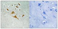 CDK5 Activator-binding C42 Polyclonal Antibody