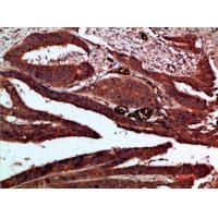 Cdk6 Polyclonal Antibody