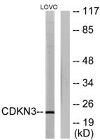 CDKN3 Polyclonal Antibody