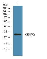 CENPQ Polyclonal Antibody
