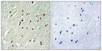 Centrobin Polyclonal Antibody